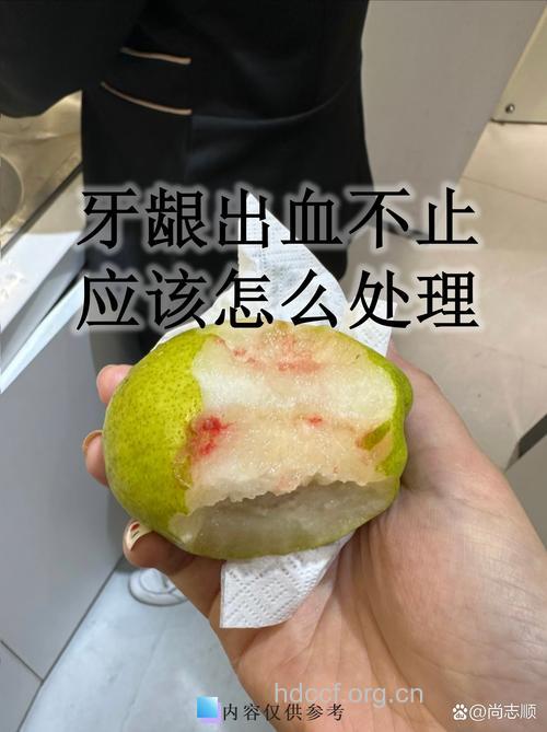 吃苹果牙龈出血小心牙周炎
