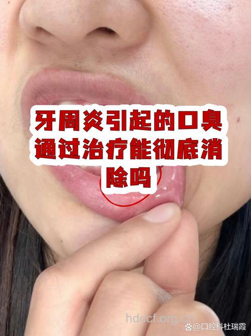 治疗牙周炎吃梨子核桃