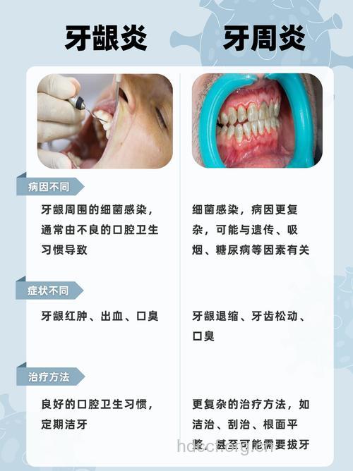 如何区分牙周炎和牙龈炎