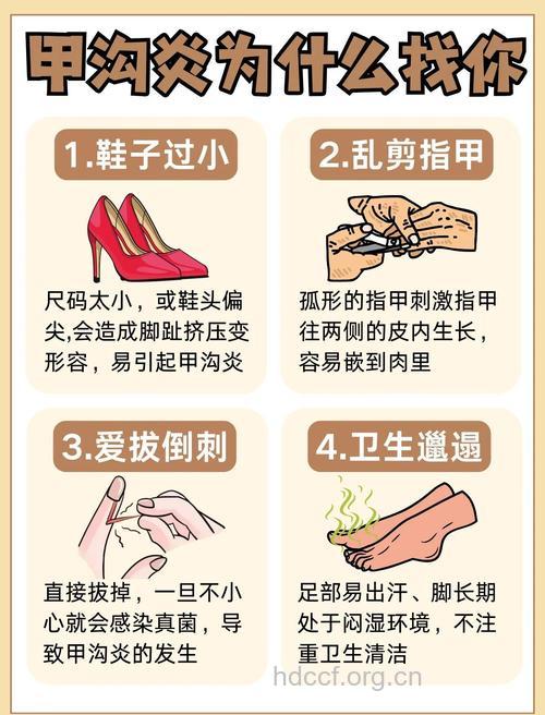 雨季湿鞋捂脚警惕患甲沟炎
