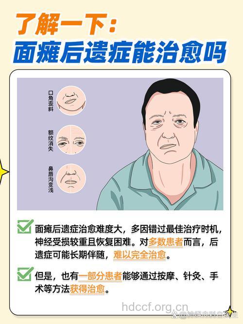 面瘫几种常见的后遗症
