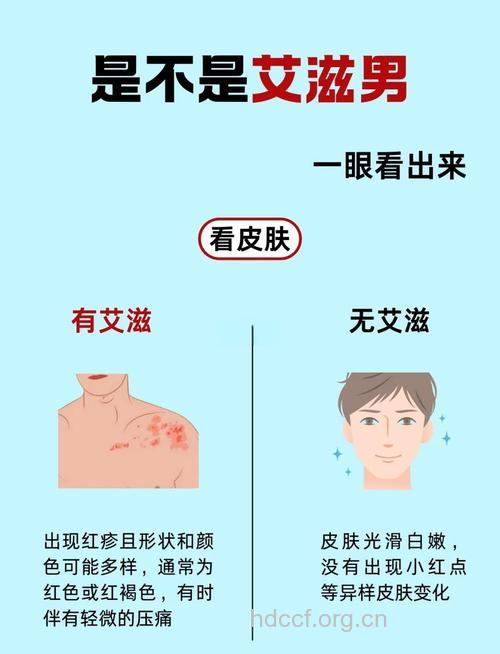 得了艾滋病 这部位一眼看出来