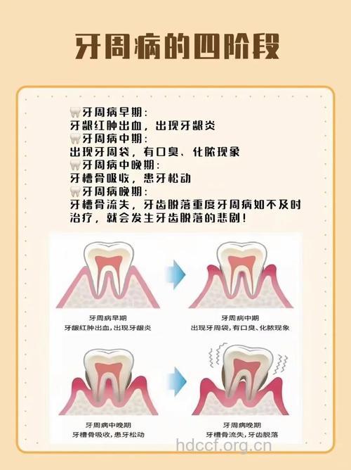 牙周炎的症状有哪些
