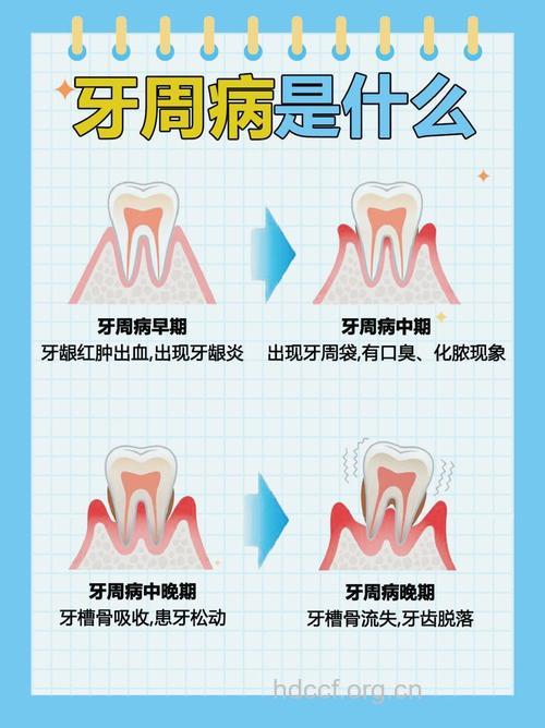 导致牙周炎出现的3种疾病