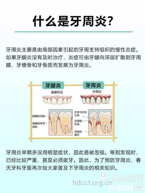 患上牙周炎的5个典型症状