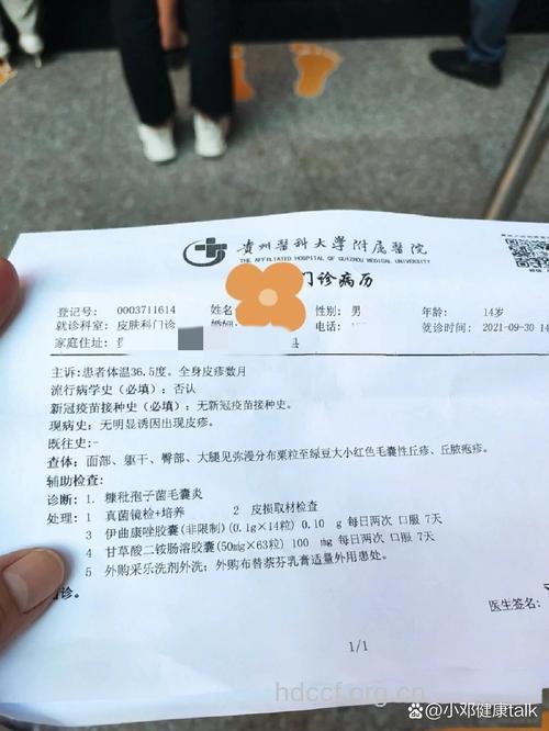 糠秕孢子菌毛囊炎病例2则