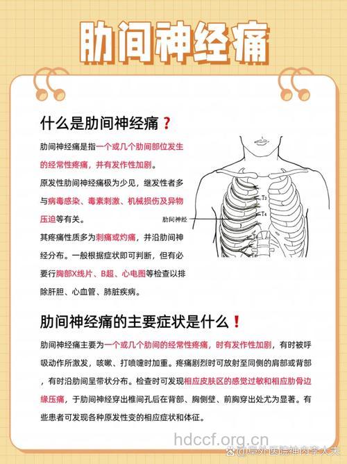 肋间神经痛的症状表现