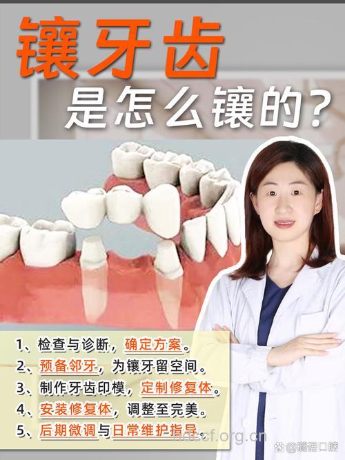 牙周炎可以镶牙吗