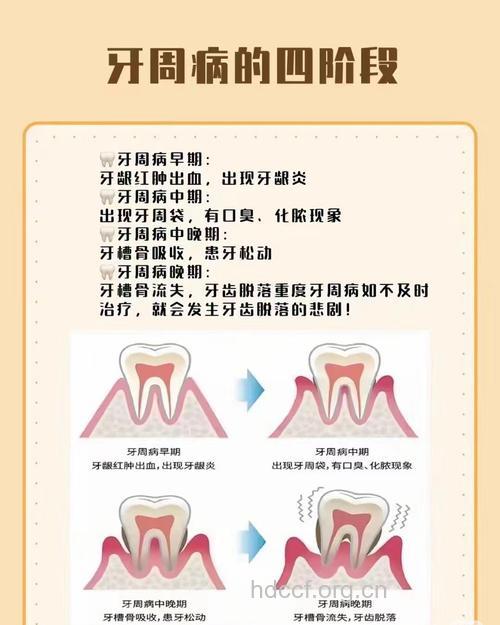 牙周病惹早产 准妈妈要当心