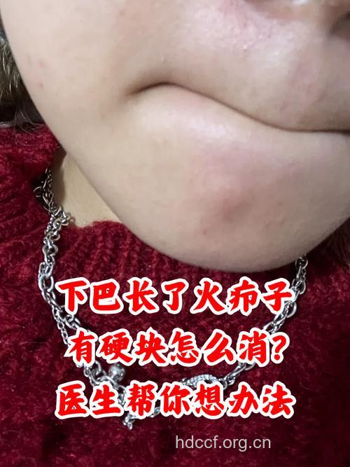 颜面部痈该如何诊断?