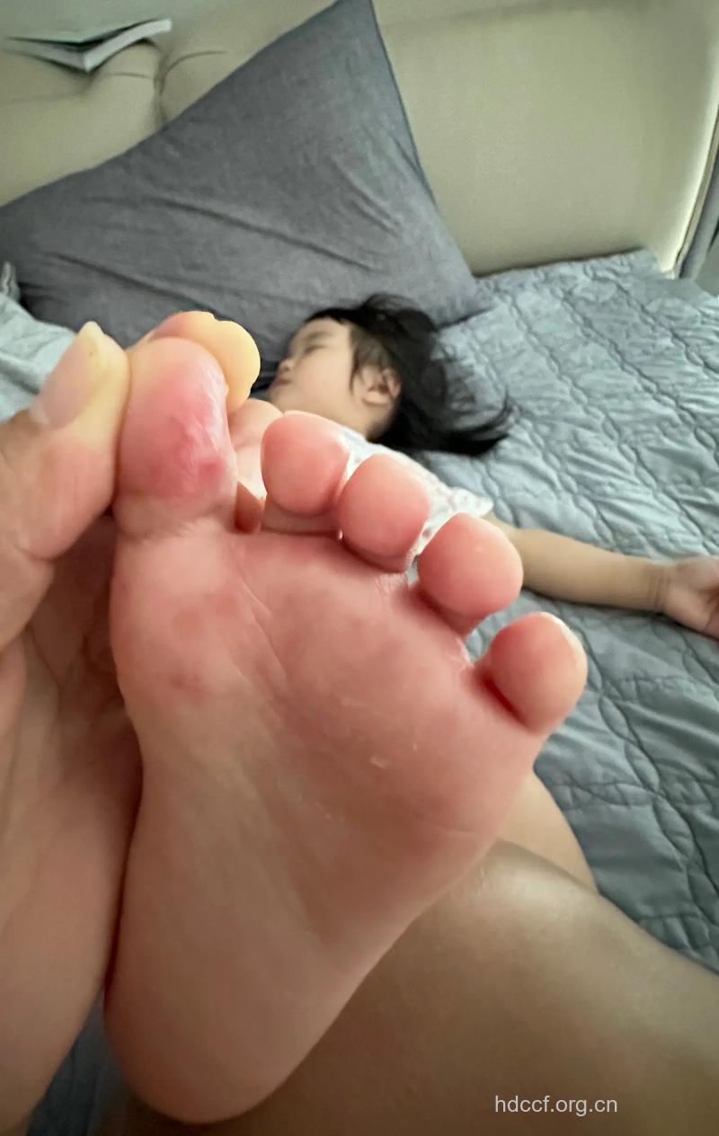 婴幼儿容易染上脚气