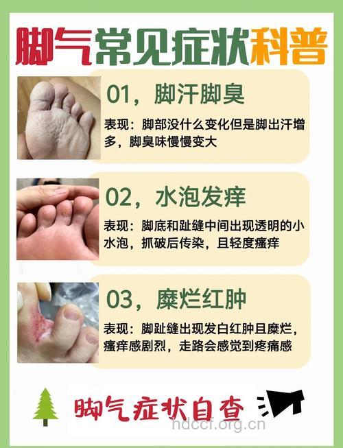 8个秘方告别足癣