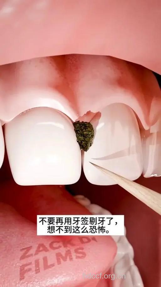牙签使用不正确的四大危害