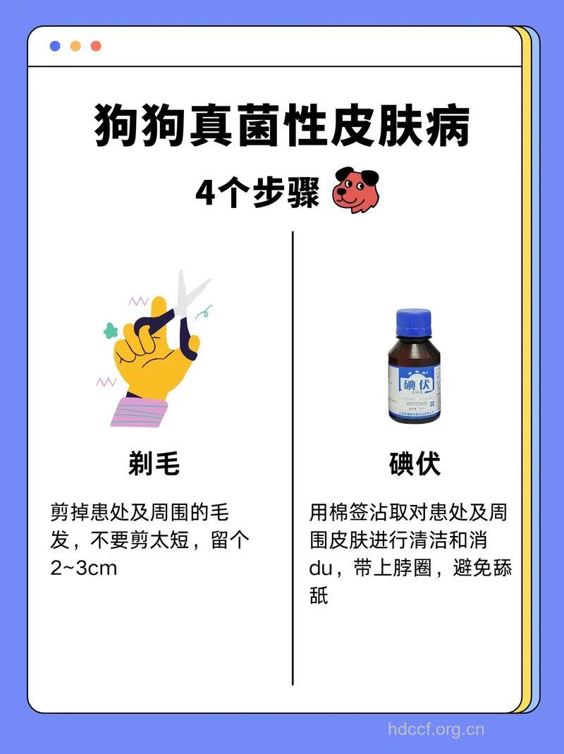 真菌性皮肤病如何治疗？