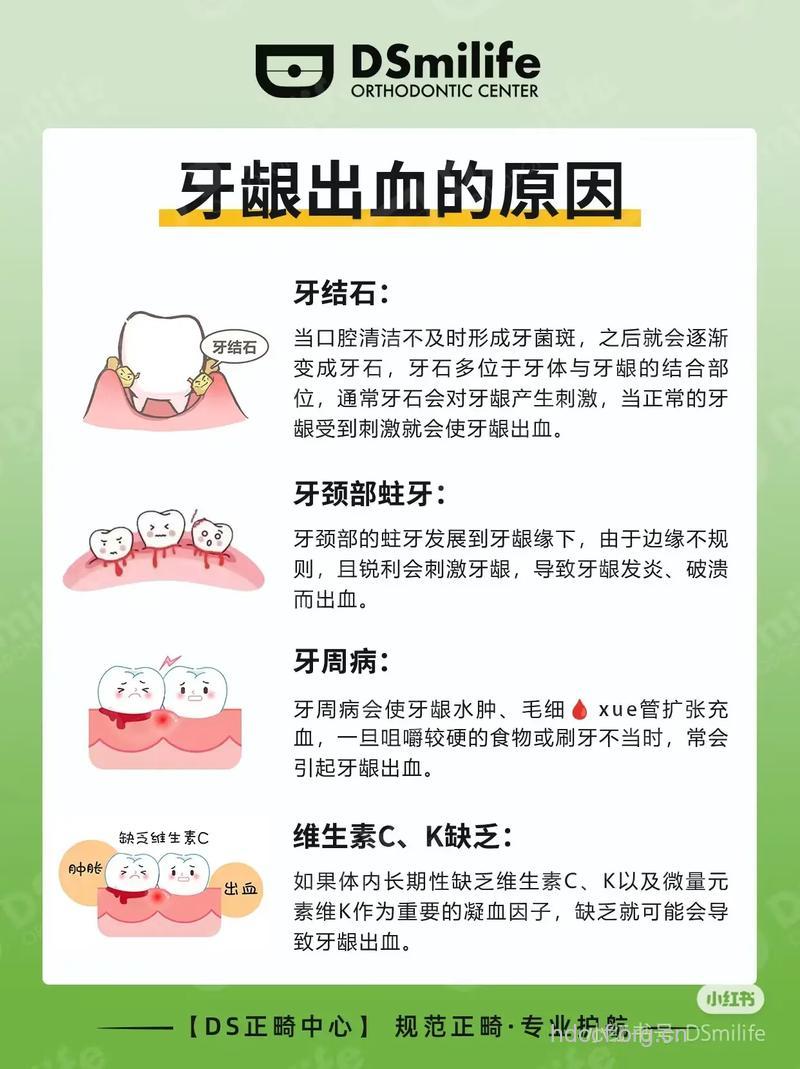 牙龈出血该怎么办？