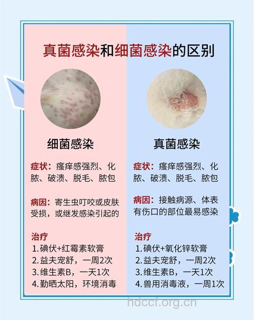 真菌性皮肤病为什么传染？