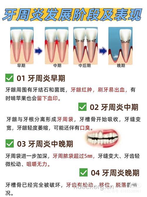 牙周炎到底有什么危害