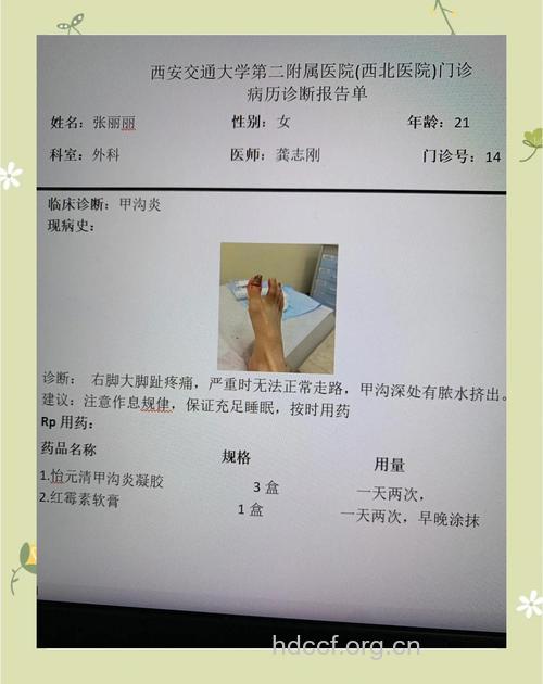 病例分析:甲沟炎手术治疗