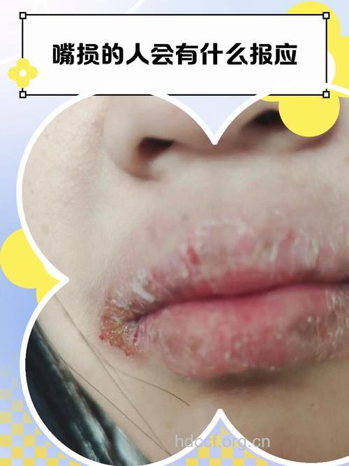 噘嘴卖萌伤害皮肤 盘点伤害皮肤的行为