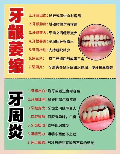 怎么判断自己是不是患了牙龈炎