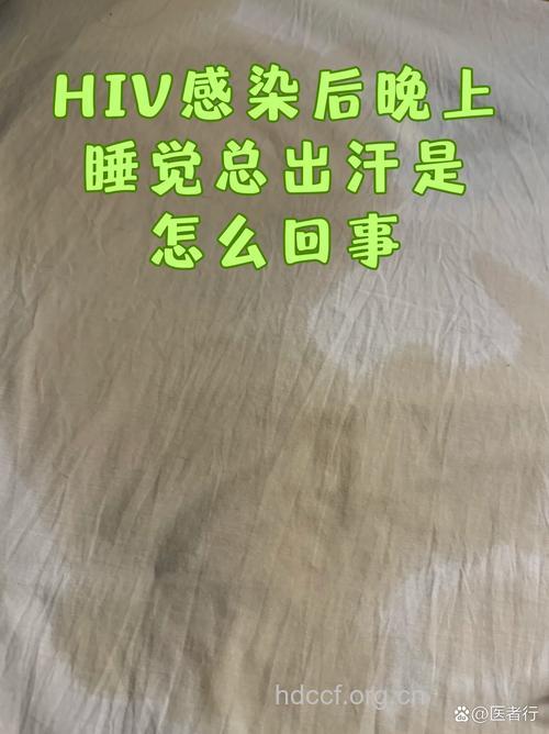 艾滋病早期症状 夜间盗汗