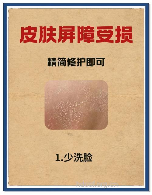 春季皮肤干燥有新招