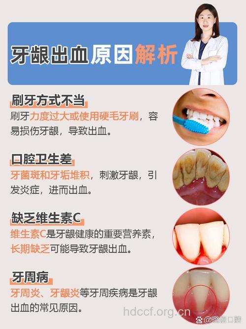 牙龈炎是牙龈出血最常见的原因