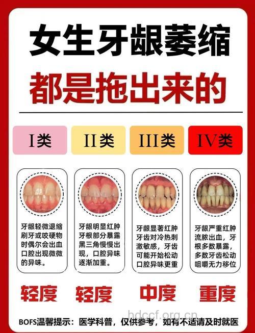 牙龈萎缩的种类与病因