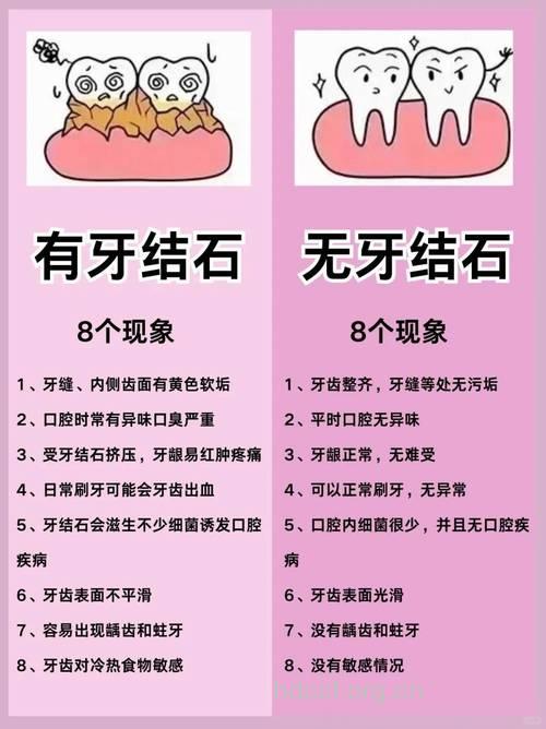 牙结石与牙龈炎有什么关系