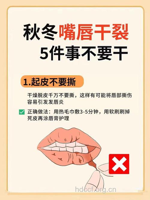冬季嘴唇干裂的护理误区