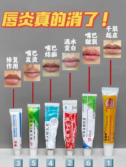 秋冬季节嘴唇干裂吃什么好