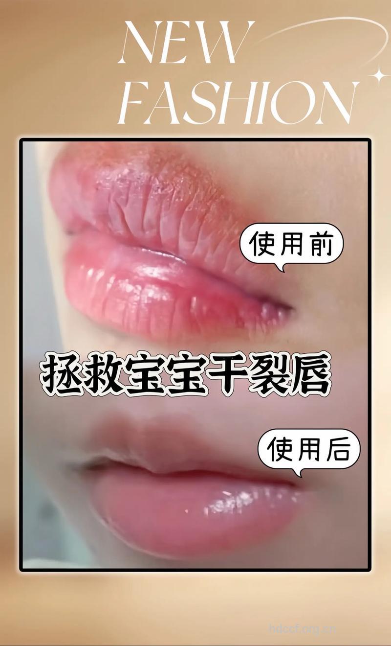 宝宝嘴唇干裂爱舔怎么办