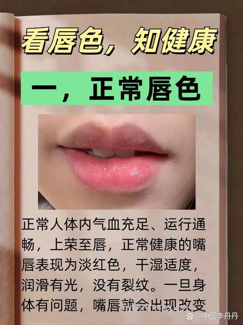 警惕嘴唇发出的六大健康信号