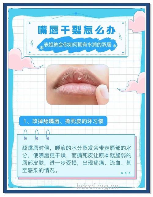 预防嘴唇干裂必须改掉四大恶习