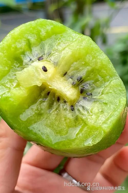 秋季嘴唇干燥起皮吃什么水果好