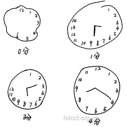 做什么运动可预防老年痴呆