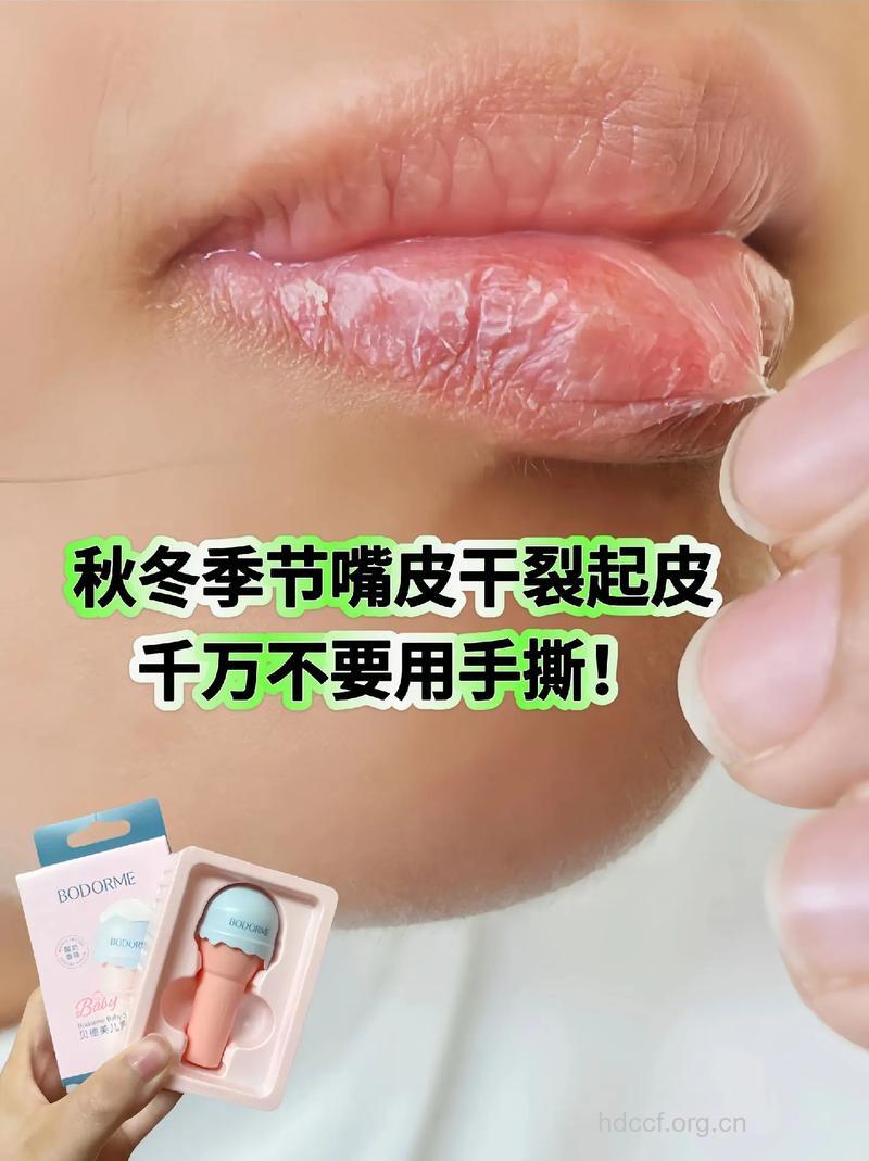 秋季宝宝嘴唇干燥起皮怎么办
