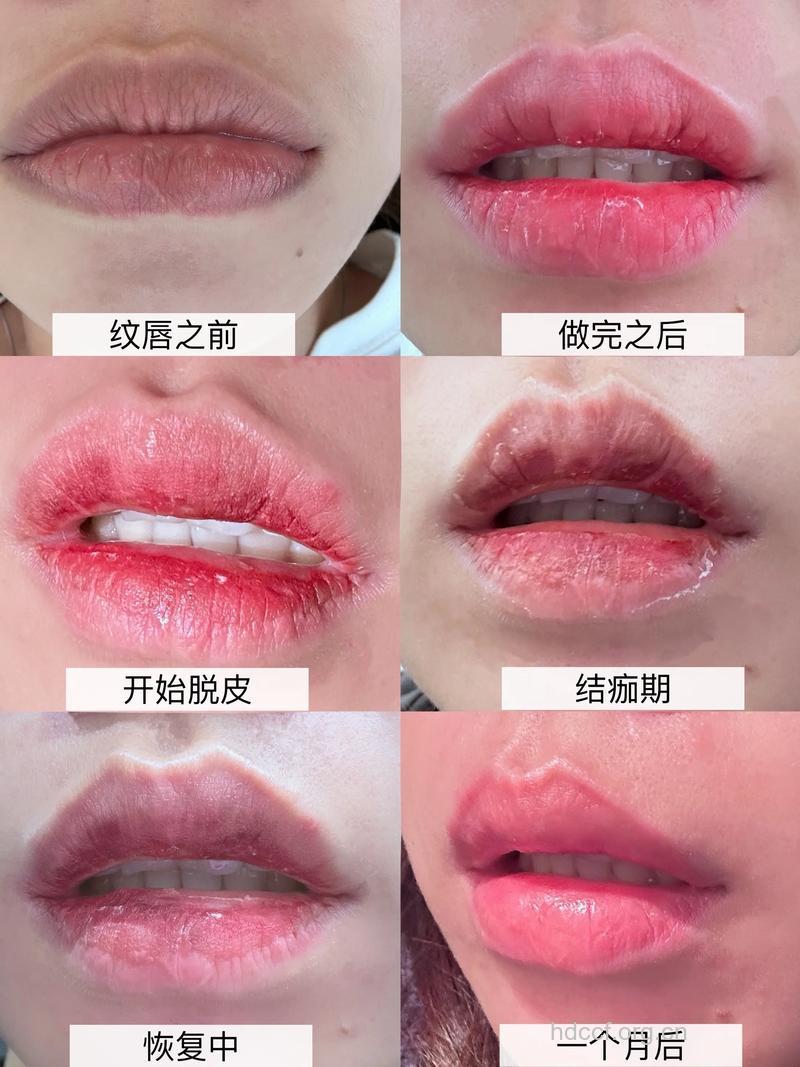 4个方法让唇纹消失