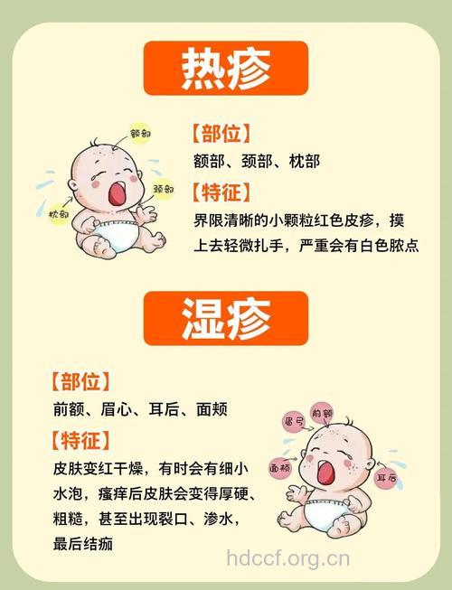 孩子皮肤娇嫩易过敏怎么办