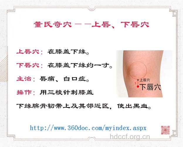针刺穴位可治疗慢性唇炎