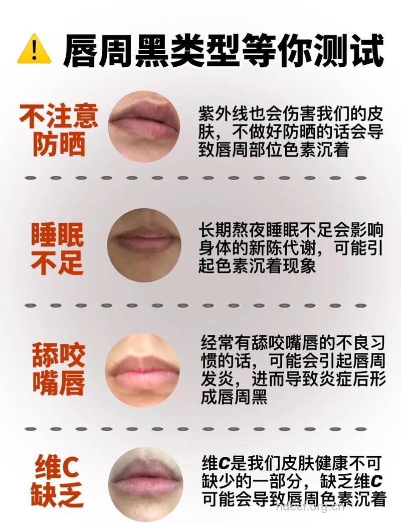 哪些原因导致嘴唇黑斑