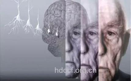 路易体痴呆的早期症状是什么
