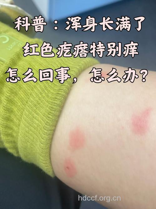 身上起红疙瘩很痒怎么回事