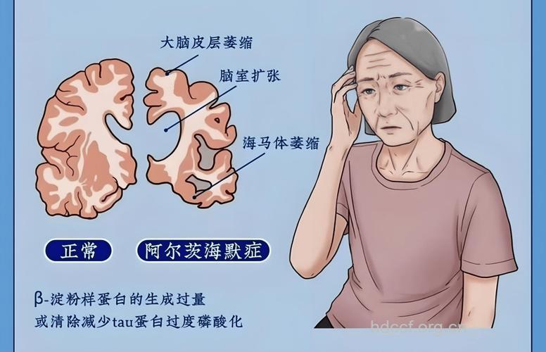 不同病变部位致痴呆的症状