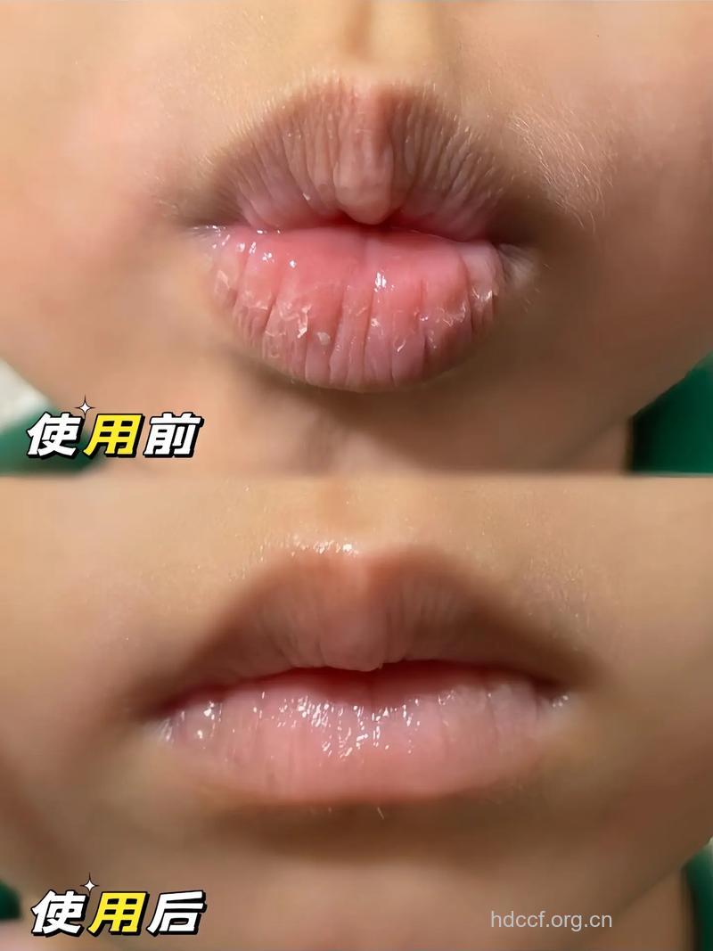 润唇膏越涂嘴唇越干