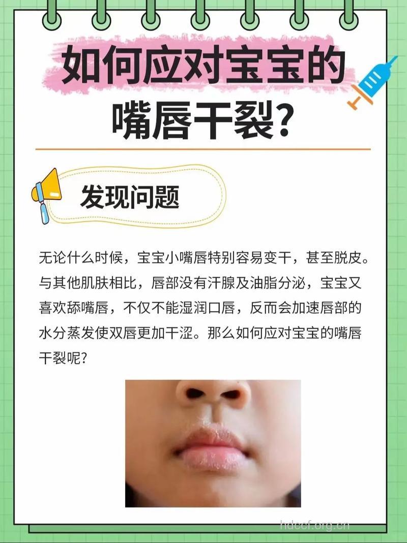 宝宝嘴唇干裂有妙招