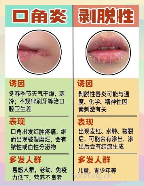 “烂嘴角”主要是因为天气原因吗?