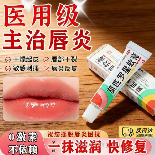 治疗唇炎可选用的药物
