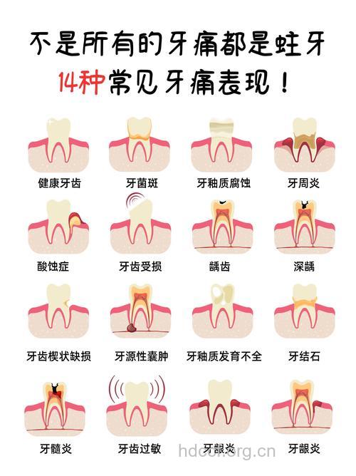 磨牙的基本症状都有哪些