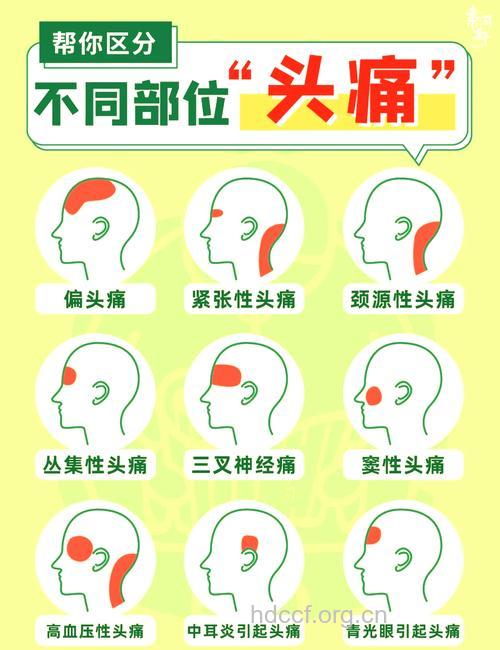 神经性头痛的常见症状